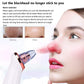 Electric Blackhead Remover Pore Vacuum Suction Diamond Dermabrasion Face Cleaner